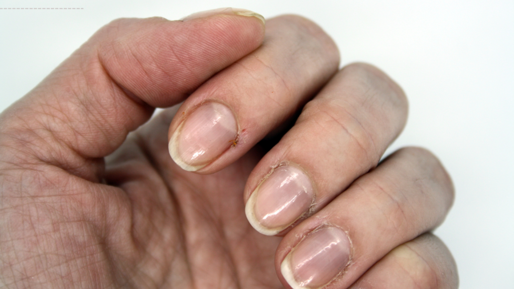 8 Best Ways to Repair Damaged Nails and Improve Nail Health Quickly
