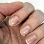8 Best Ways to Repair Damaged Nails and Improve Nail Health Quickly